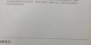 上海太安医院治疗肺结节的费用贵不贵？