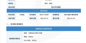 mNGS锁定类鼻疽伯克霍尔德菌感染